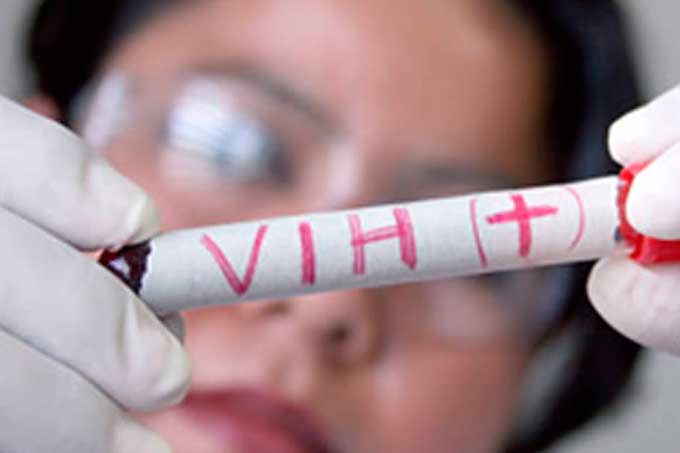 Cientificos VIH Cura 
