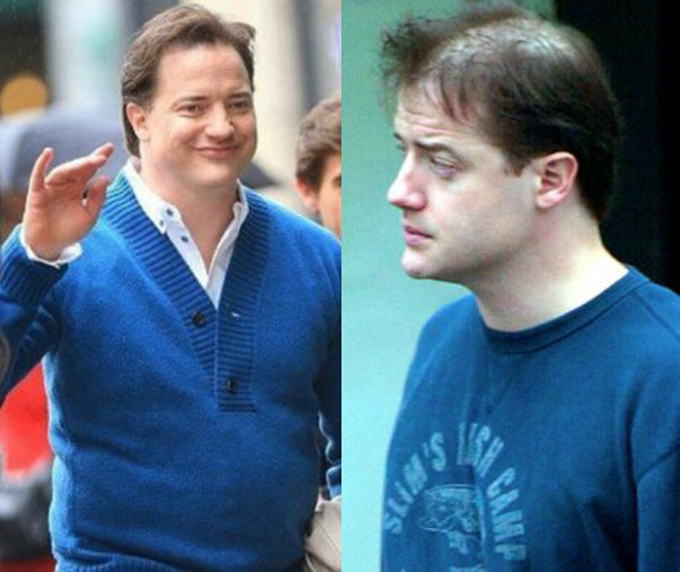 Brendan Fraser