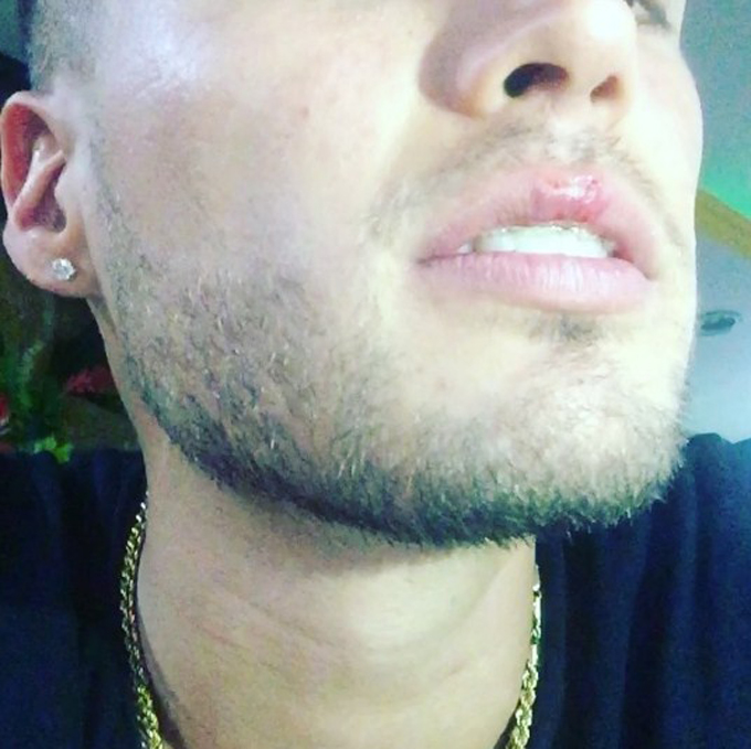 Gustavo Elis